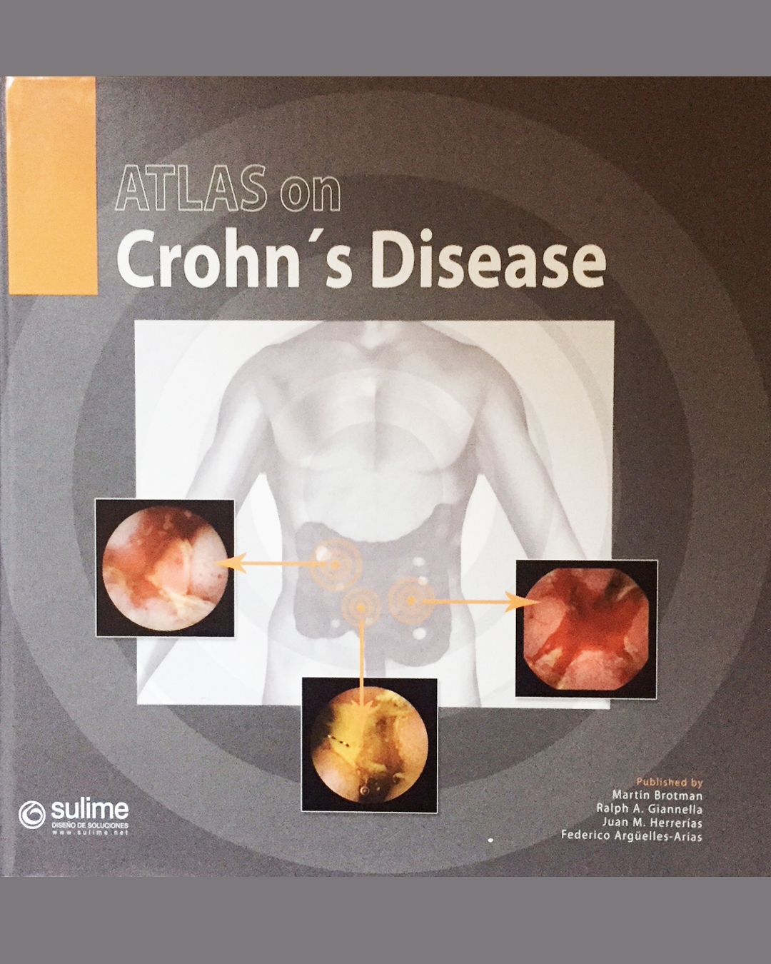 Atlas on Crohn's disease